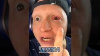 When you have pink eye #comedy #funny #gamer #relatable #skit